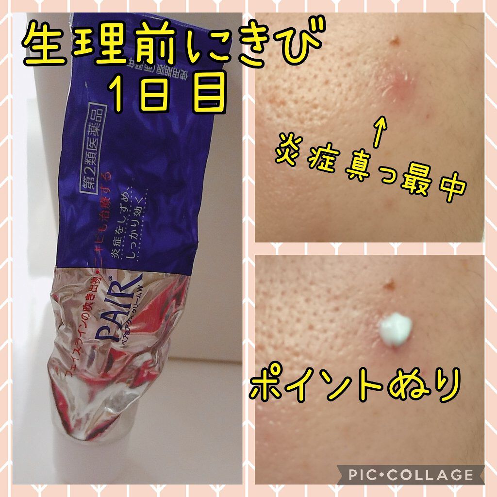 を使ったクチコミ（1枚目）