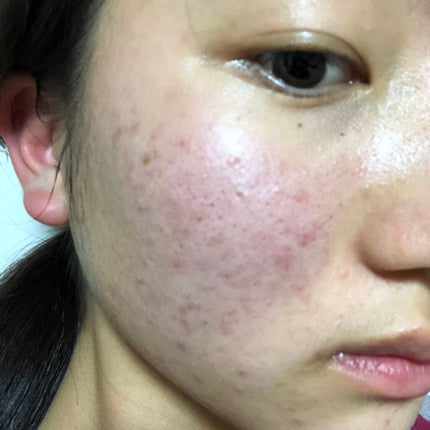 を使ったクチコミ(2枚目)