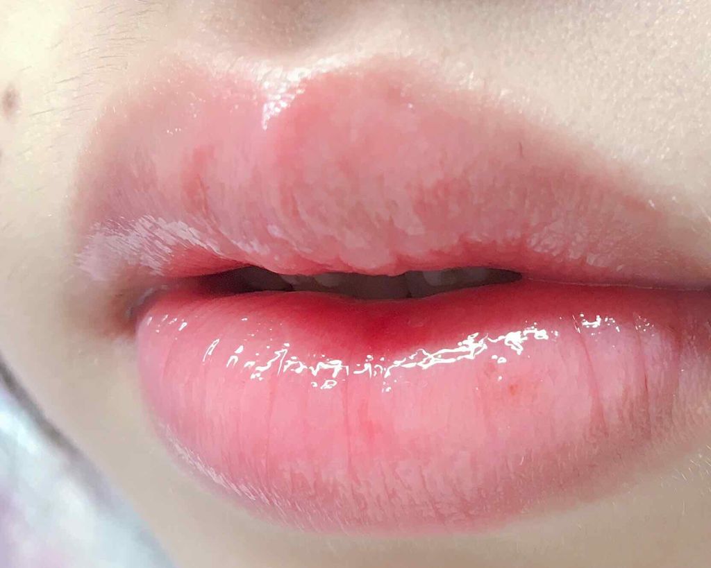 リップフォンデュ/メンソレータム/リップバームを使ったクチコミ（2枚目）