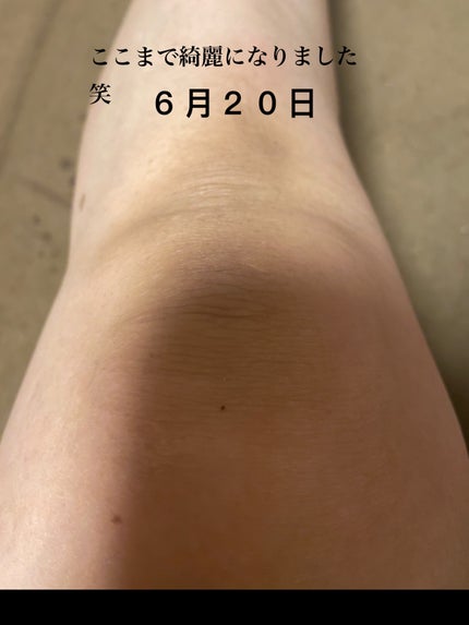 マイクワゾウスキ【フォロバ100%】 on LIPS 「おはようございます。汚い写真ですみません。私、油断すると片膝だ..」(3枚目)