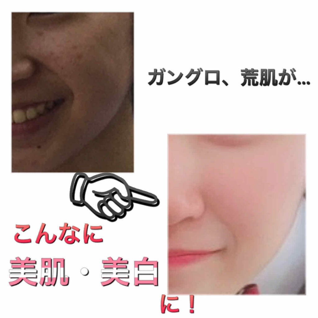 ハトムギ化粧水(ナチュリエ スキンコンディショナー R )/ナチュリエ/化粧水を使ったクチコミ（1枚目）