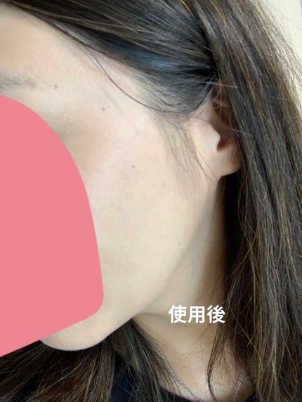 Wエッセンス/shimaboshi/美容液を使ったクチコミ(4枚目)