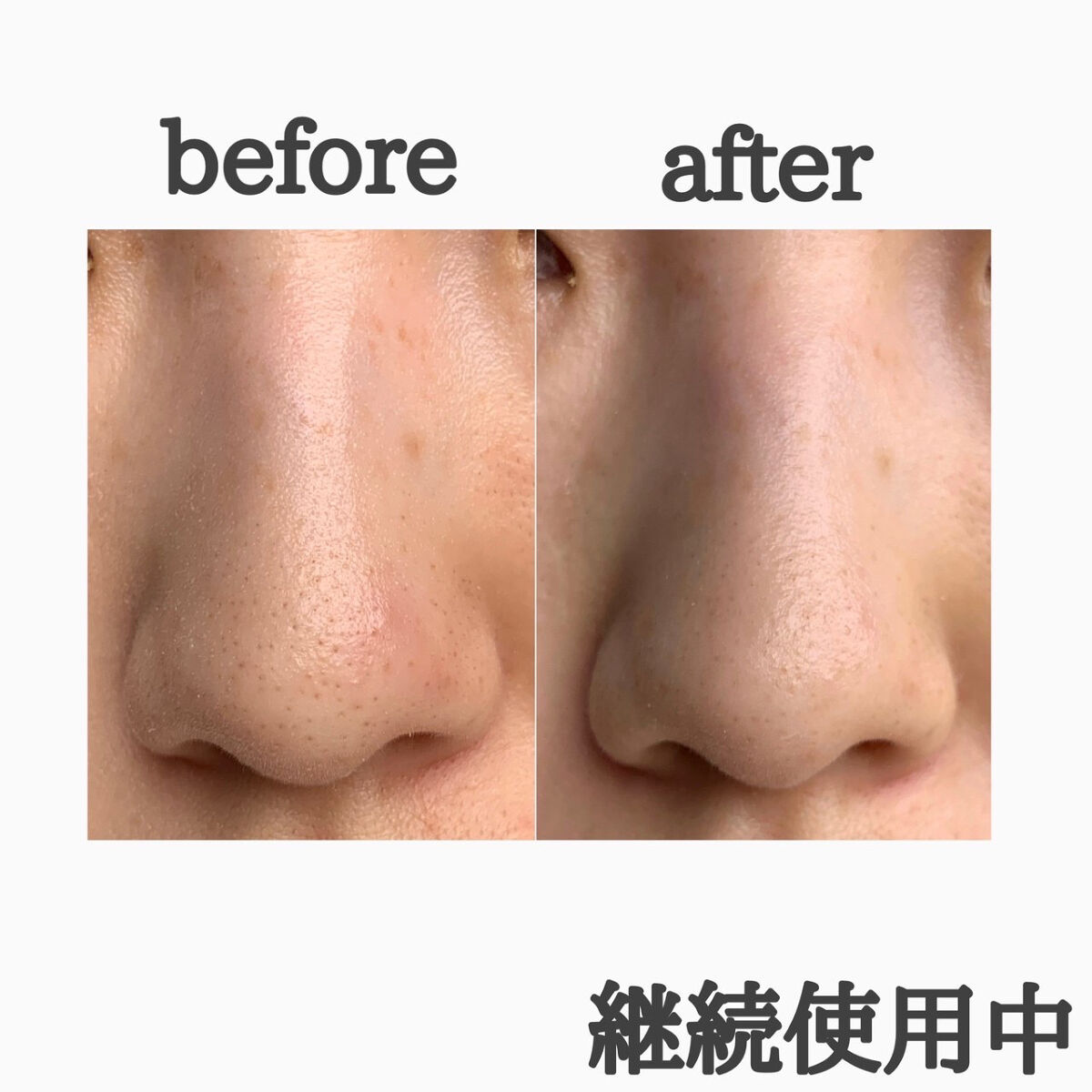 なごみ炭酸スパウォッシュ/プリモディーネ/泡洗顔を使ったクチコミ（3枚目）