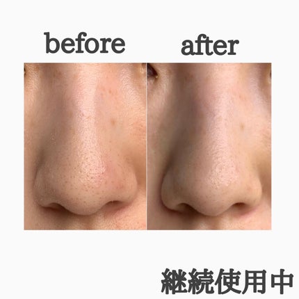 なごみ炭酸スパウォッシュ/プリモディーネ/泡洗顔を使ったクチコミ(3枚目)