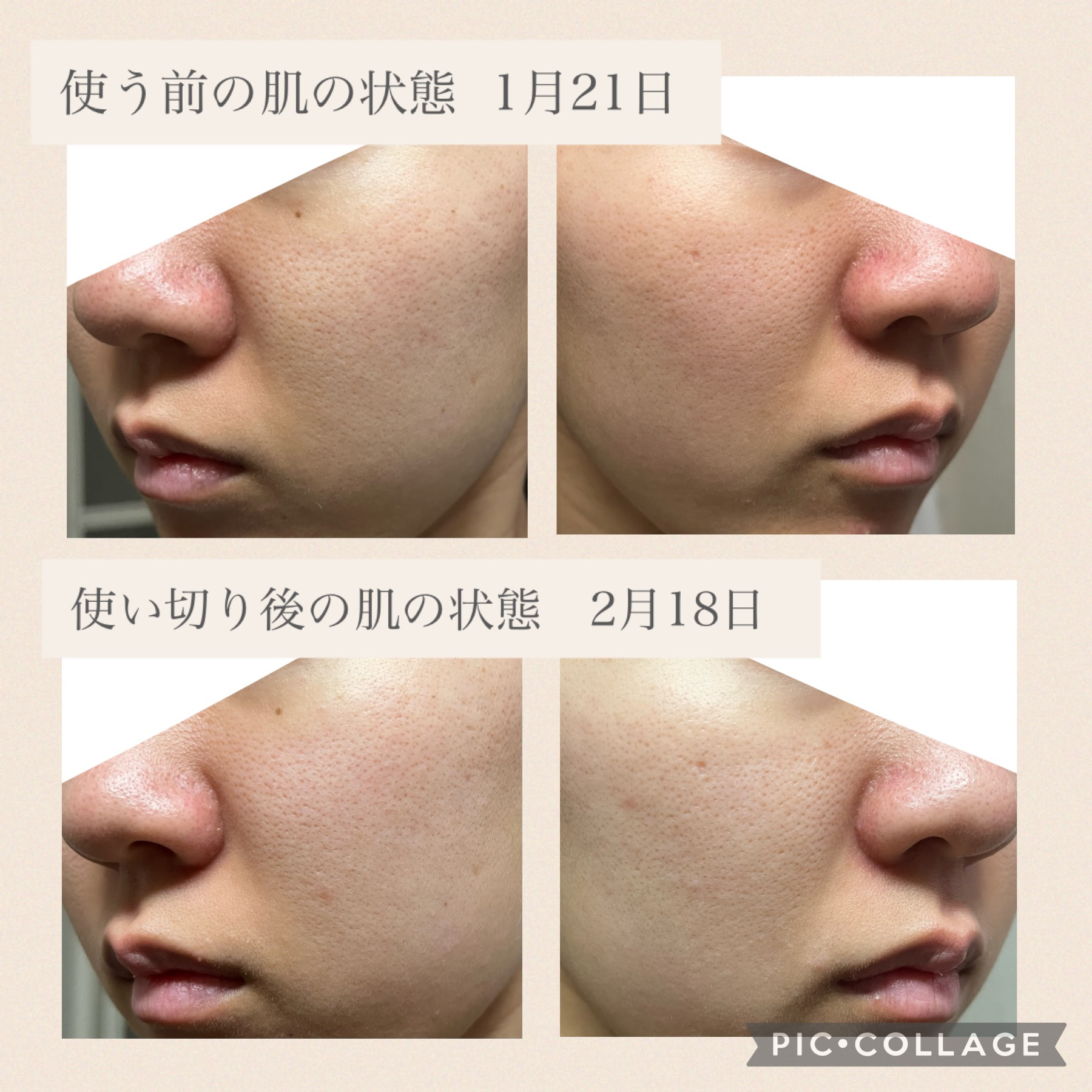 V エッセンス/unlabel/美容液を使ったクチコミ（3枚目）