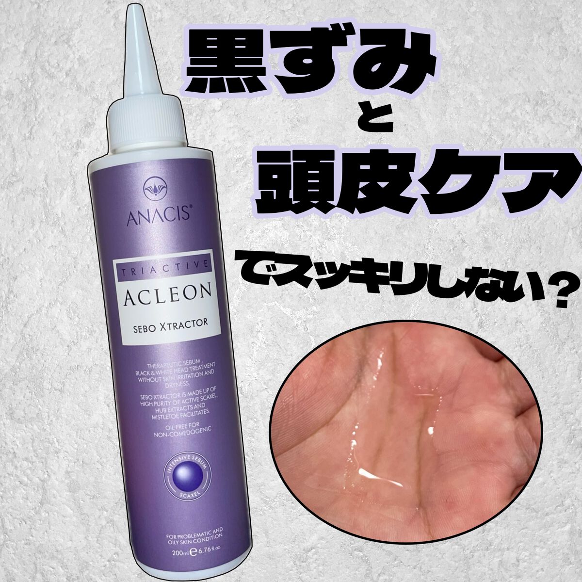 アクレオンセボエクストラクター/ANACIS/その他スキンケアを使ったクチコミ(1枚目)