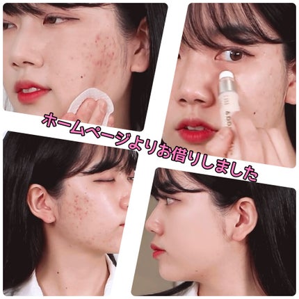 パーフェクトスポットEパフコンシーラー/APRILSKIN/リキッドコンシーラーを使ったクチコミ(4枚目)