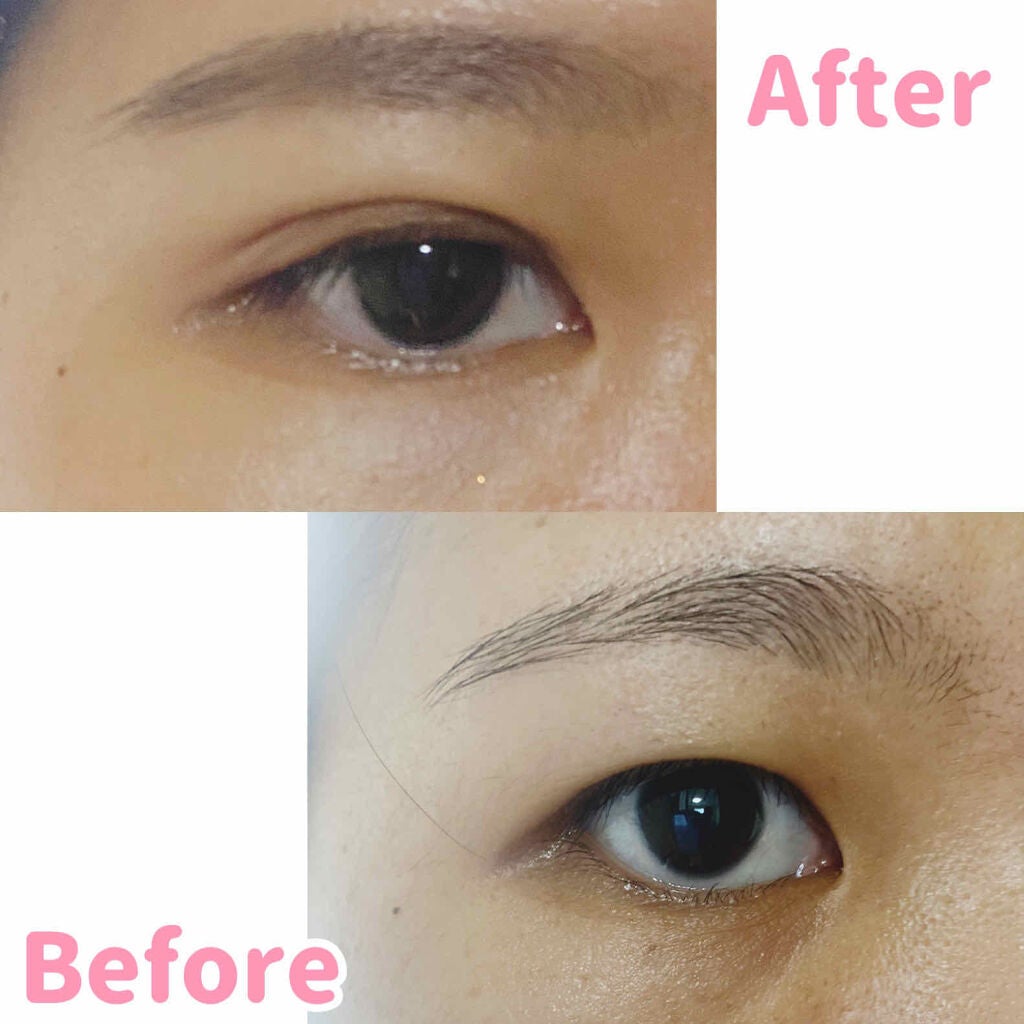 オリシキ アイリッドスキンフィルム /D-UP/二重まぶた用アイテムを使ったクチコミ(3枚目)