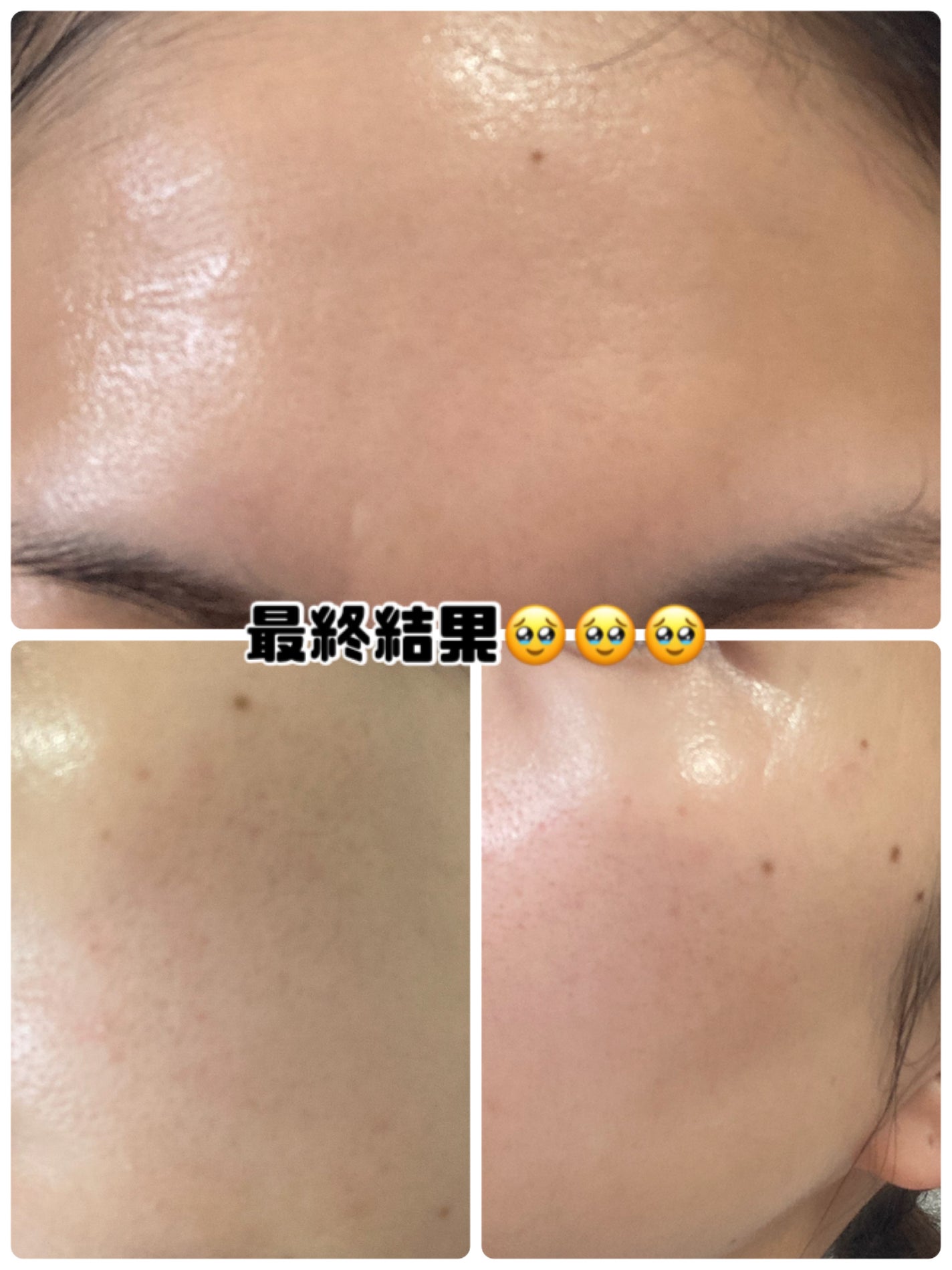 パンテショット675/COSNORI/美容液を使ったクチコミ(3枚目)