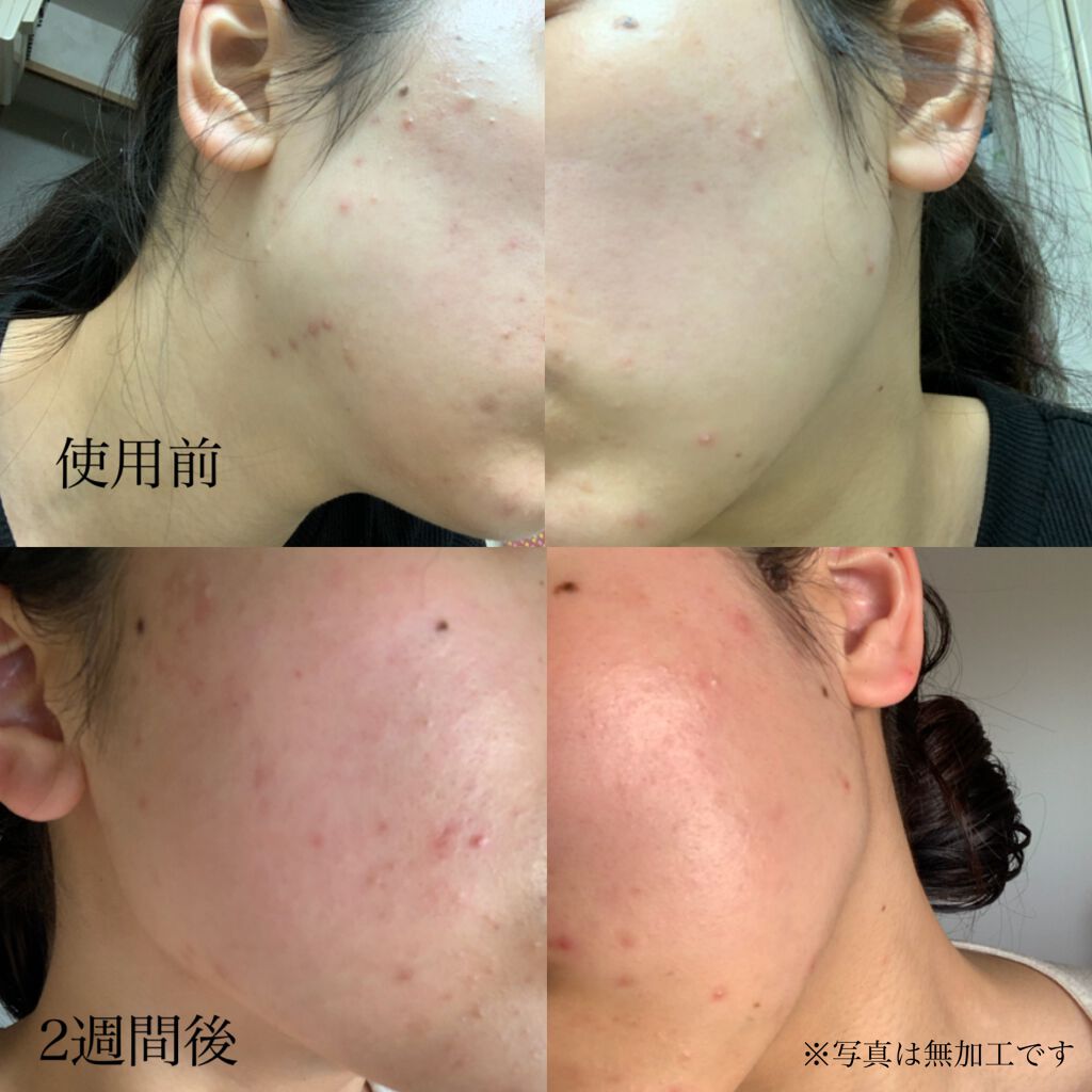 デュオ ザ クレンジングバーム クリア/DUO/クレンジングバームを使ったクチコミ（2枚目）