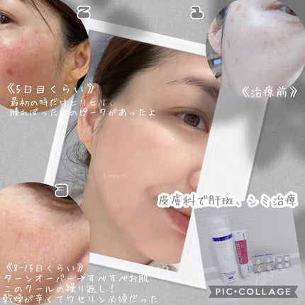 UVエッセンス SPF30/キュレル/日焼け止め・UVケアを使ったクチコミ(4枚目)