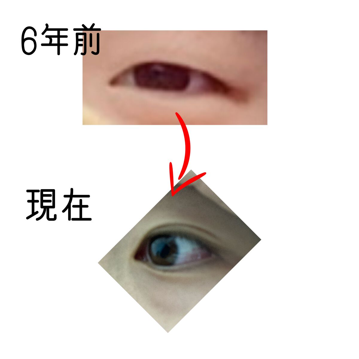 のびーるアイテープ（絆創膏タイプ、レギュラー）/DAISO/二重まぶた用アイテムを使ったクチコミ（1枚目）