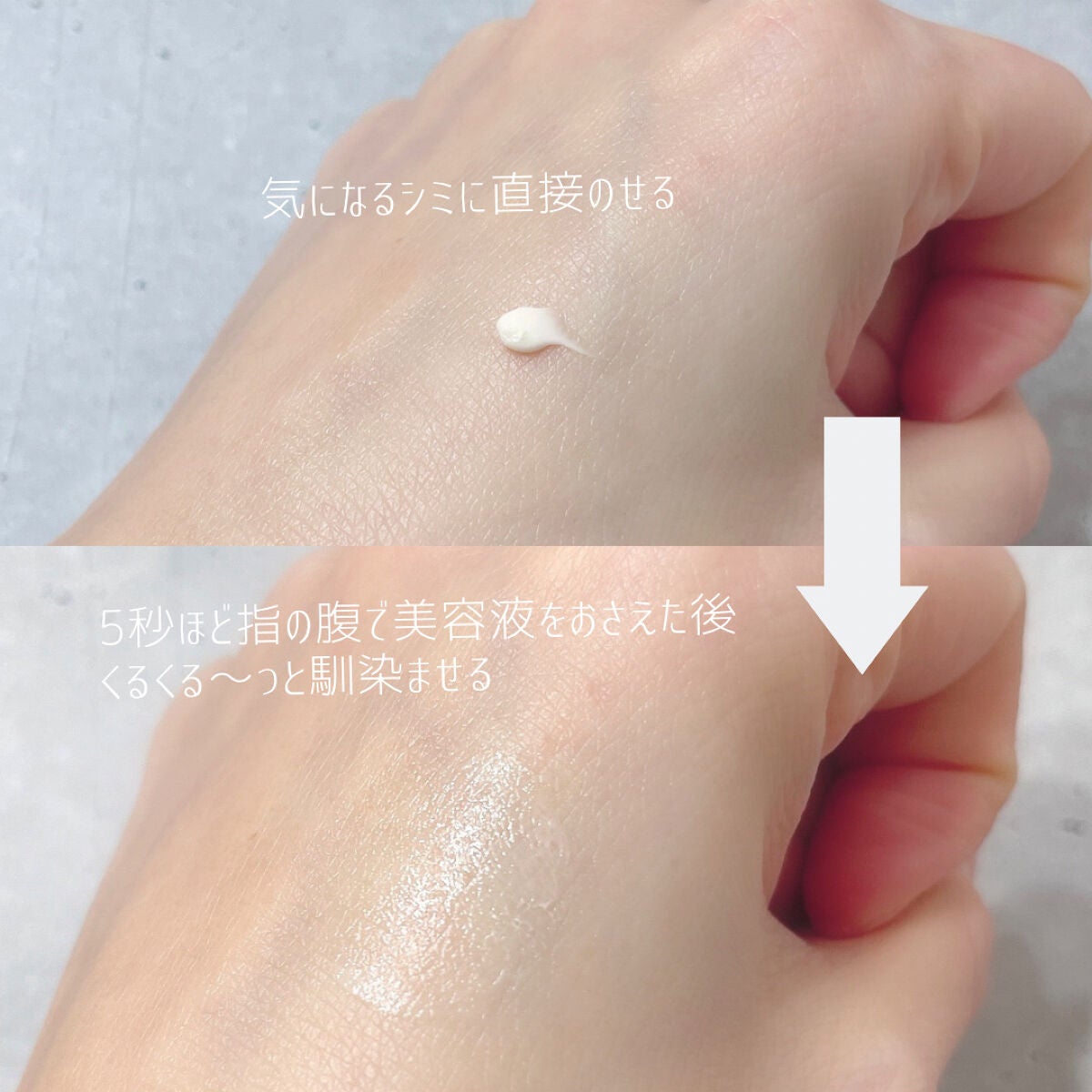 ホワイトショット SXS N/ホワイトショット/美容液を使ったクチコミ(3枚目)