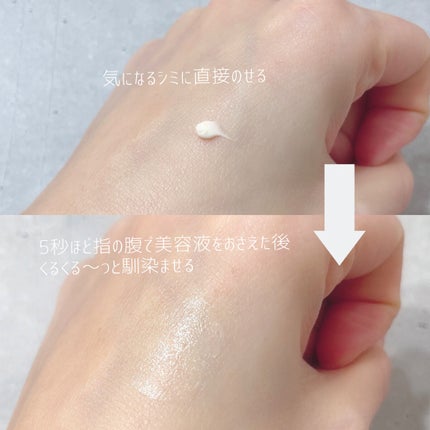 ホワイトショット SXS N/ホワイトショット/美容液を使ったクチコミ(3枚目)