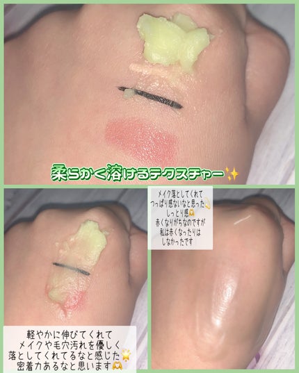 グリーンディープポアクレンジングバーム/Dr.G/クレンジングバームを使ったクチコミ(4枚目)