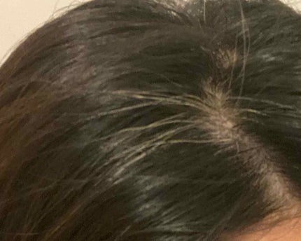 カラートリートメント/テンスター/ヘアカラーを使ったクチコミ(2枚目)