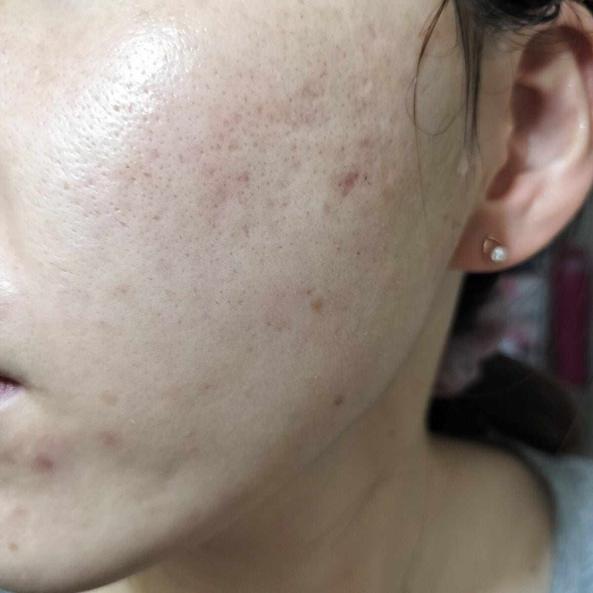 ビオオイル アルガンオイル/Melvita/フェイスオイルを使ったクチコミ(1枚目)