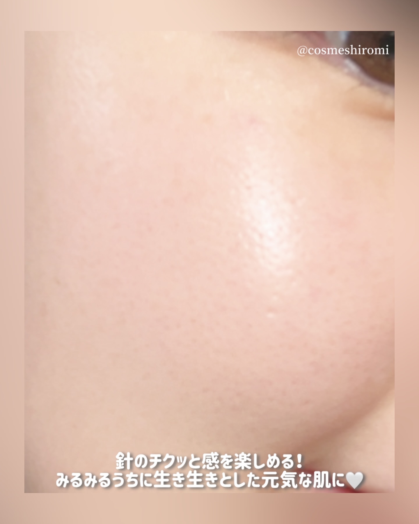 プラムペプチドブースター2000S/Isntree/美容液を使ったクチコミ（2枚目）