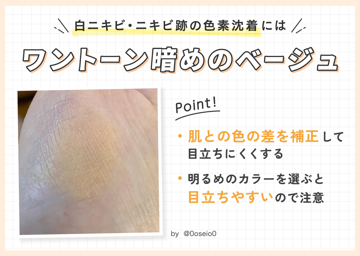 白ニキビ・ニキビ跡の色素沈着にはワントーン暗めのベージュ。肌と色の差を補正して目立ちにくくする。明るめのカラーを選ぶと目立ちやすいので注意。