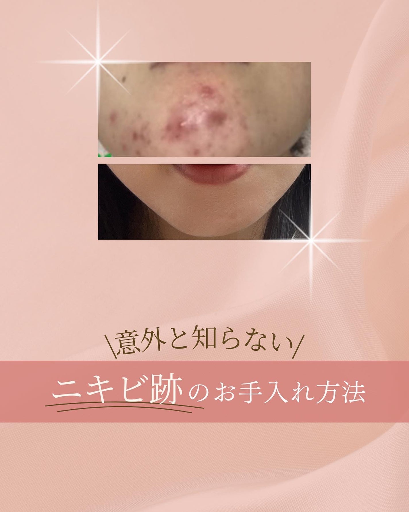 ã¿ãð¹ on LIPS ãæå€ãšç¥ããªã/ãããè·¡ã®ãæå
¥ãæ¹æ³ð¡ãããè·¡ãæ¹åãããã..ãïŒ1æç®ïŒ