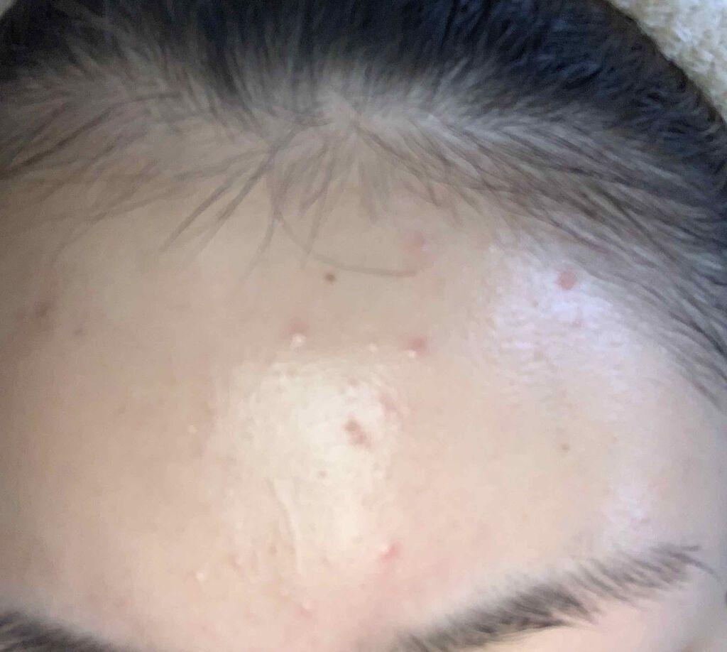 化粧水・敏感肌用・高保湿タイプ/無印良品/化粧水を使ったクチコミ(1枚目)