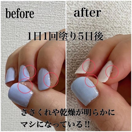ザ キューティクルオイル/ADDICTION/ネイルオイル・トリートメントを使ったクチコミ(4枚目)