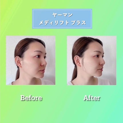 メディリフト /YA-MAN TOKYO JAPAN/美顔器・マッサージを使ったクチコミ(9枚目)