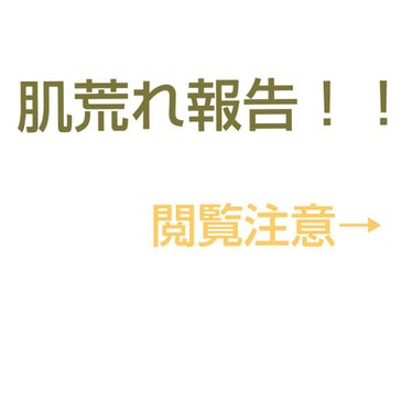 こんにちは！まゆおです！！
お久しぶりです〜。今回はただ私の今の汚肌をご報告します。
この1週間でだいぶ荒れちゃいました(ーー;)
写真だけでも気持ち悪いですね(´°̥̥̥̥̥̥̥̥ω°̥̥̥̥̥̥̥̥