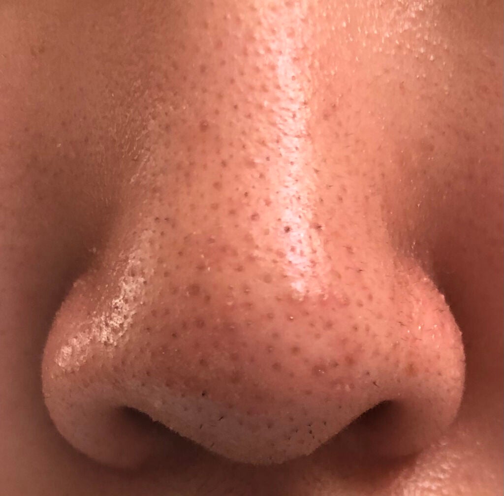 ハトムギ化粧水(ナチュリエ スキンコンディショナー R )/ナチュリエ/化粧水を使ったクチコミ(2枚目)