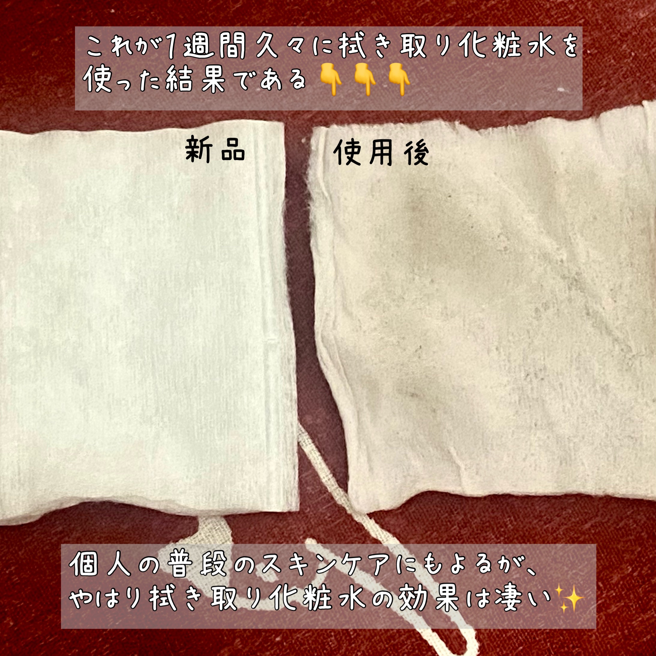 オイデルミン（N）/SHISEIDO/化粧水を使ったクチコミ（3枚目）