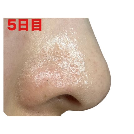 3番 緑茶炭毛穴パッククレンジングバーム/numbuzin/クレンジングバームを使ったクチコミ(8枚目)