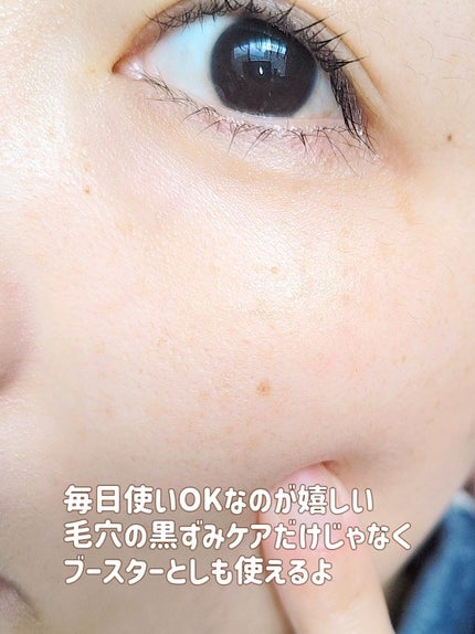 ミミチュールインスパイア ミー!バブル パック/クラブ/洗い流すパック・マスクを使ったクチコミ(5枚目)