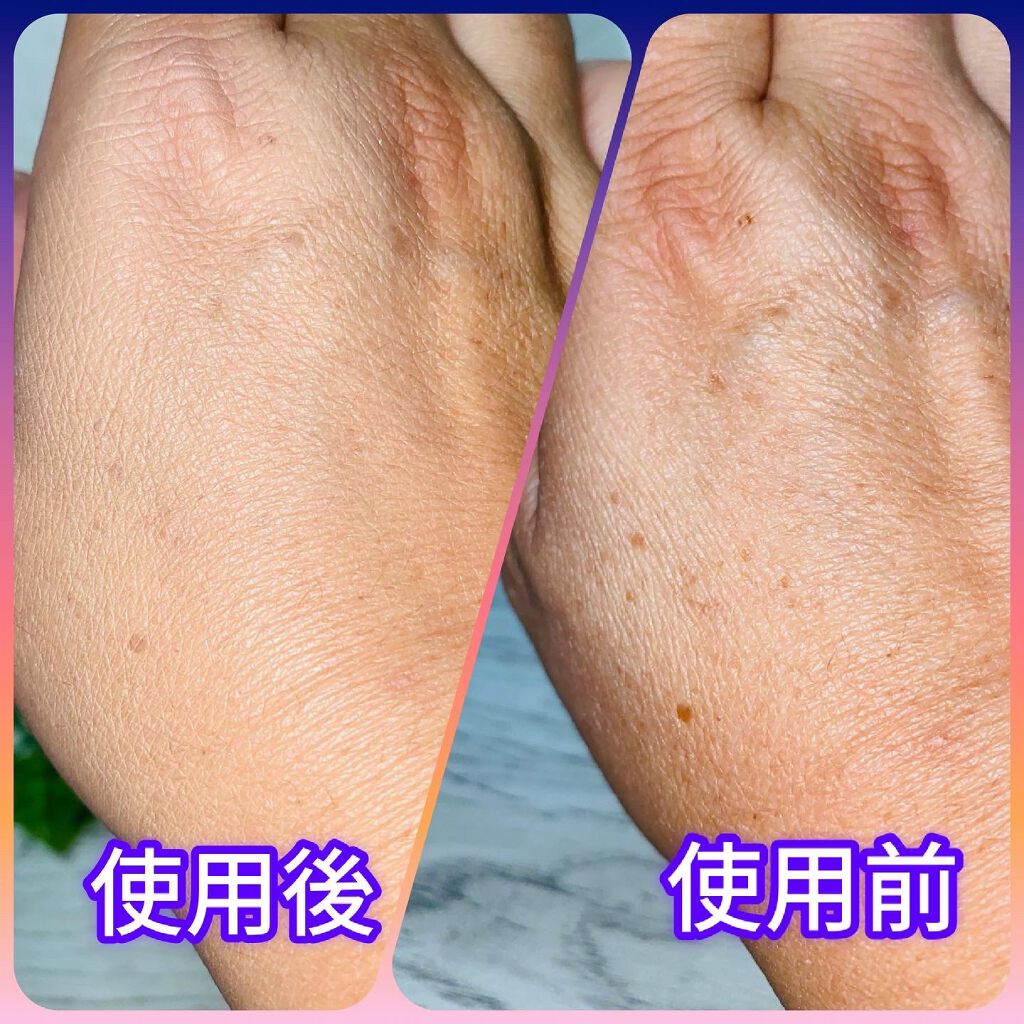 シルキー フィット/COVERMARK/パウダーファンデーションを使ったクチコミ（1枚目）