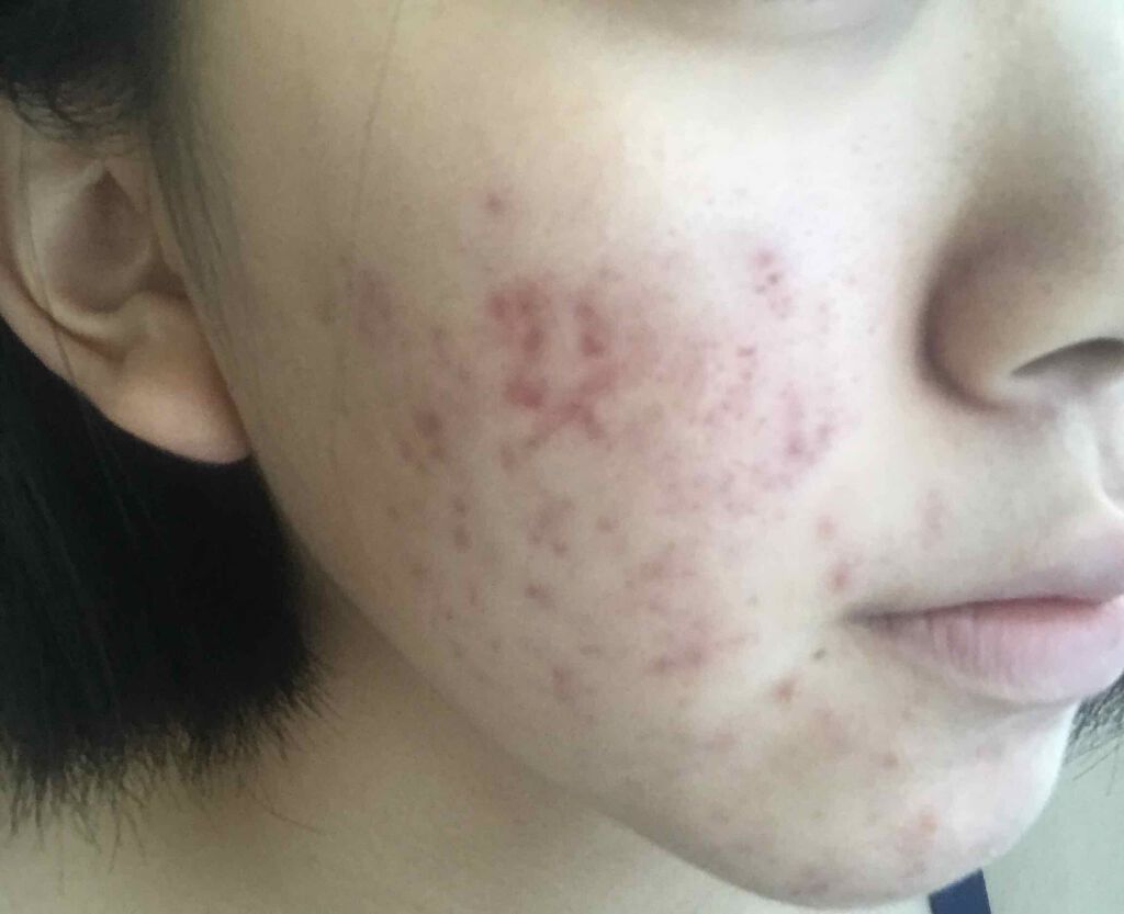 を使ったクチコミ（1枚目）