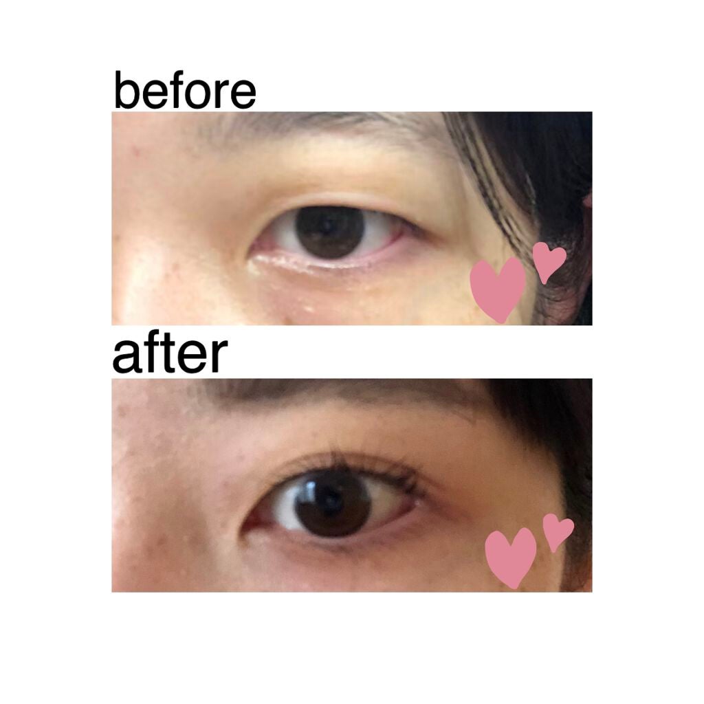 おとぎ on LIPS 「初めまして、おとぎです🐇記念すべきリップス初投稿は私が二重にな..」(2枚目)