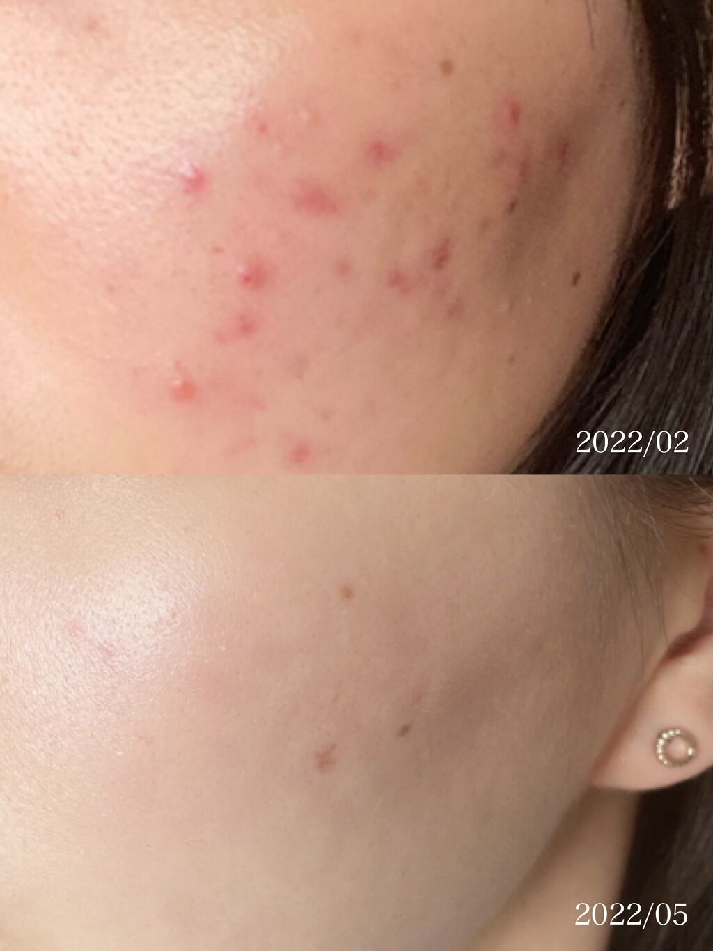 ドクダミ化粧水/ONE THING/化粧水を使ったクチコミ（2枚目）