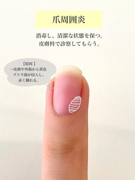 ビューティーチャージ ナイトスペリア/アトリックス/ハンドクリームを使ったクチコミ(7枚目)