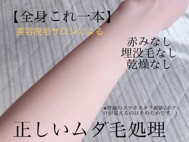 【正しいムダ毛処理の方法】
※画像は腕の外側部分です。

急上昇ありがとうございます！！
こんにちは。
長年美容サロンに通っている者です。
今回は今までサロンなどで情報を集めてきたムダ毛処理の方法につい