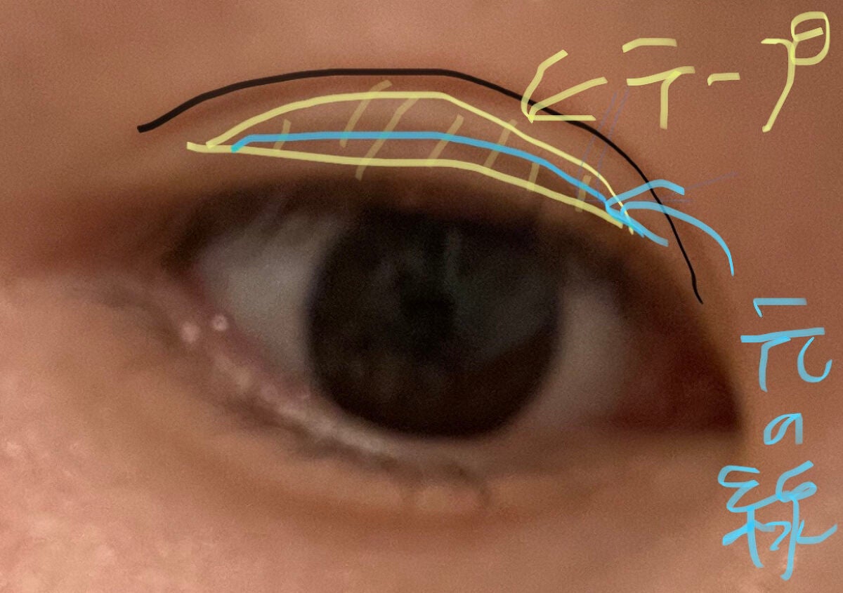 メッシュアイテープ/DAISO/二重まぶた用アイテムを使ったクチコミ(2枚目)