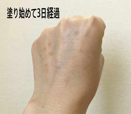 アセロラダークスポット&ブレミッシュ ケア クリーム/RAVIEL/フェイスクリームを使ったクチコミ(4枚目)