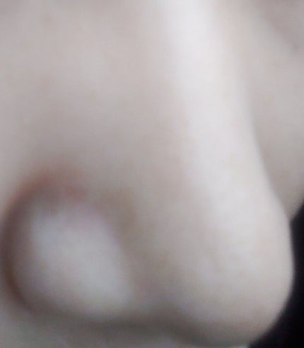 毛穴小町マスク		/クリアターン/シートマスク・パックを使ったクチコミ(3枚目)