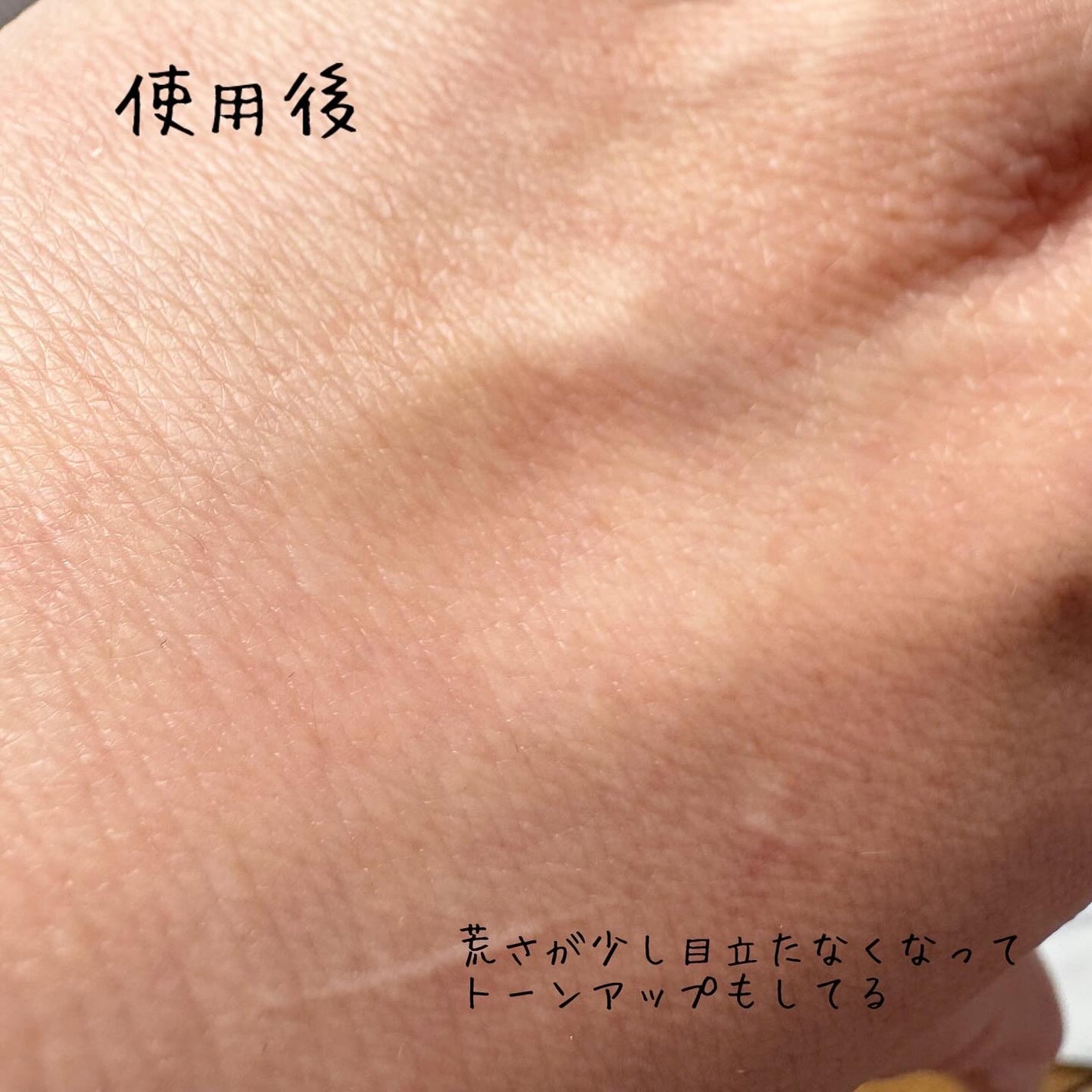 PDRNピンクアンプル PDRN 10,000ppm配合/MEDICUBE/美容液を使ったクチコミ(5枚目)