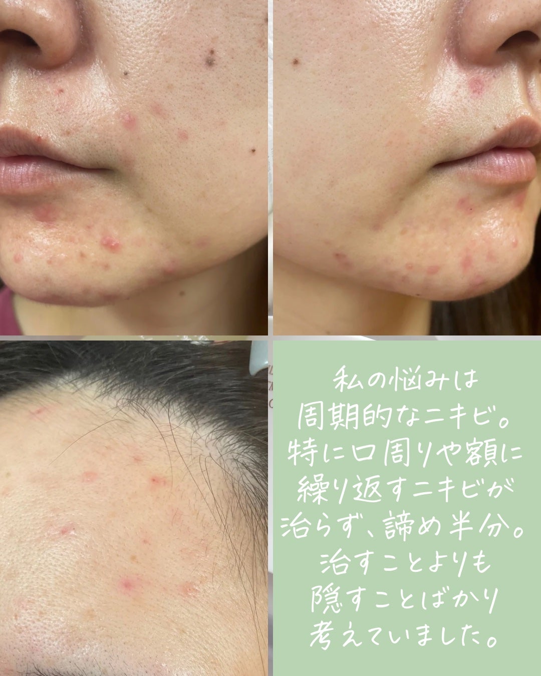 フルフィルメント セラム ウォーター インテンス90|Herz skinの フルフィルメント セラム ウォーター インテンス90|Herz skinの