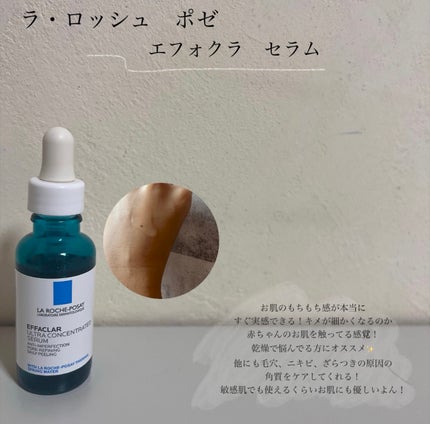 ãšãã¡ã¯ã© ããŒã«ã±ã¢ ã»ã©ã /ã© ããã·ã¥ ããŒ/çŸå®¹æ¶²ã䜿ã£ãã¯ãã³ãïŒ5æç®ïŒ