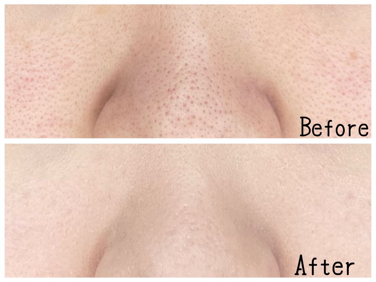 フィットミー リキッドファンデーション R/MAYBELLINE NEW YORK/リキッドファンデーションを使ったクチコミ（2枚目）