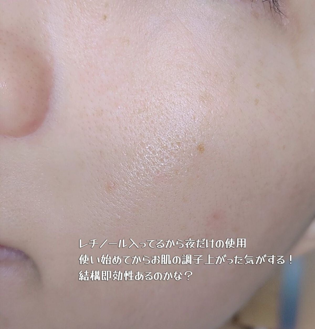 3番 集中ケアレチノール美容液/numbuzin/美容液を使ったクチコミ(3枚目)
