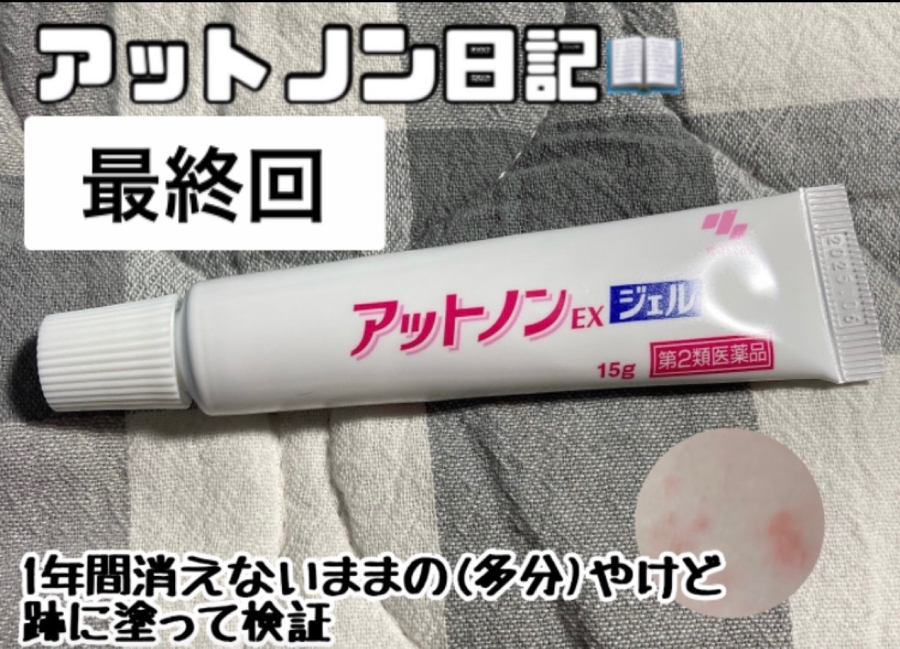 EXジェル 15g】 EXジェル 15g×2個 30g】 Amazon | 【第2類医薬品】