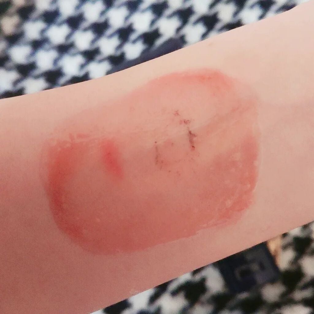 モイストゲルクレンジング/Re dermalab/クレンジングジェルを使ったクチコミ(6枚目)