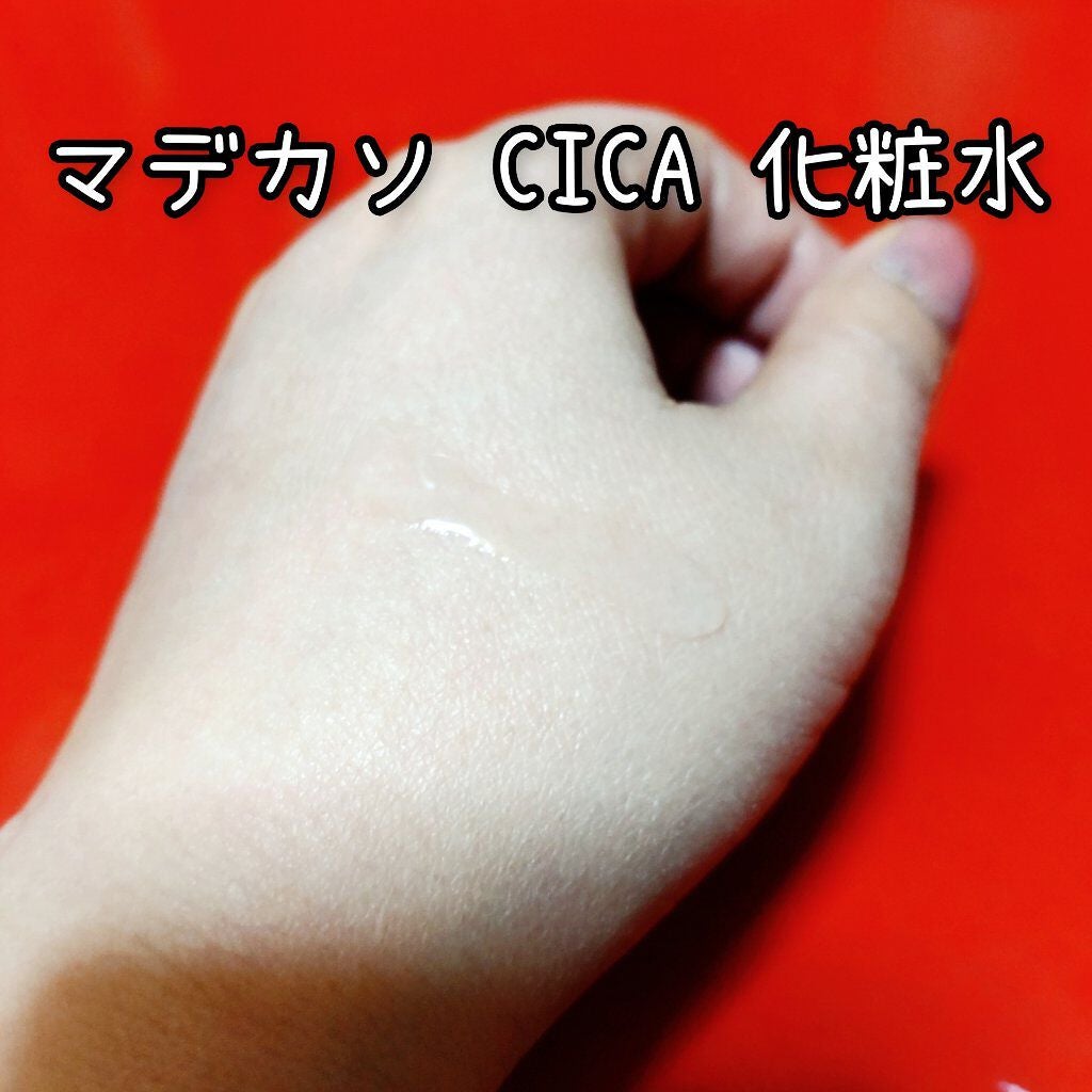 マデカソ CICA化粧水/A’pieu/化粧水を使ったクチコミ(2枚目)