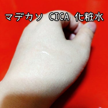 マデカソ CICA化粧水/A’pieu/化粧水を使ったクチコミ（2枚目）